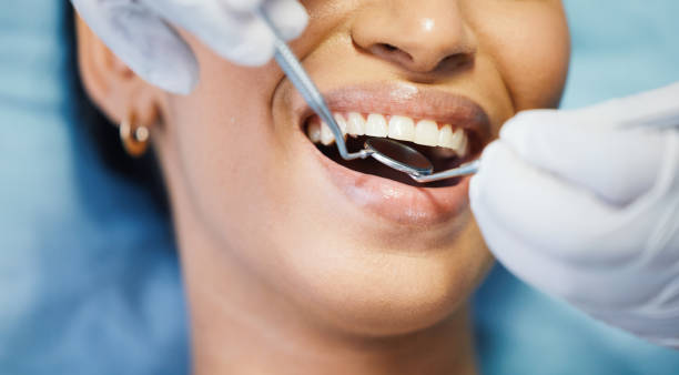 Best After-Hours Dental Trauma Care in Yosemite Lakes, CA