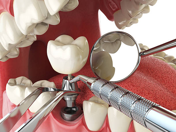 Best Cosmetic Emergency Dentistry in Yosemite Lakes, CA